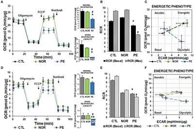 Soluble Fms-Like Tyrosine Kinase-1 Alters Cellular Metabolism and Mitochondrial Bioenergetics in Preeclampsia